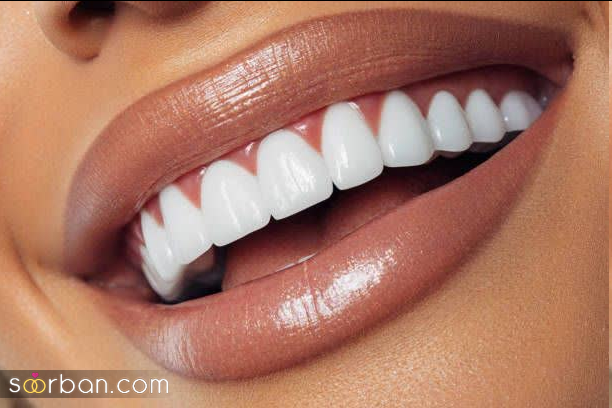 سفید کردن دندان ها با 12 راهکار شگفت انگیز خانگی و کم هزینه