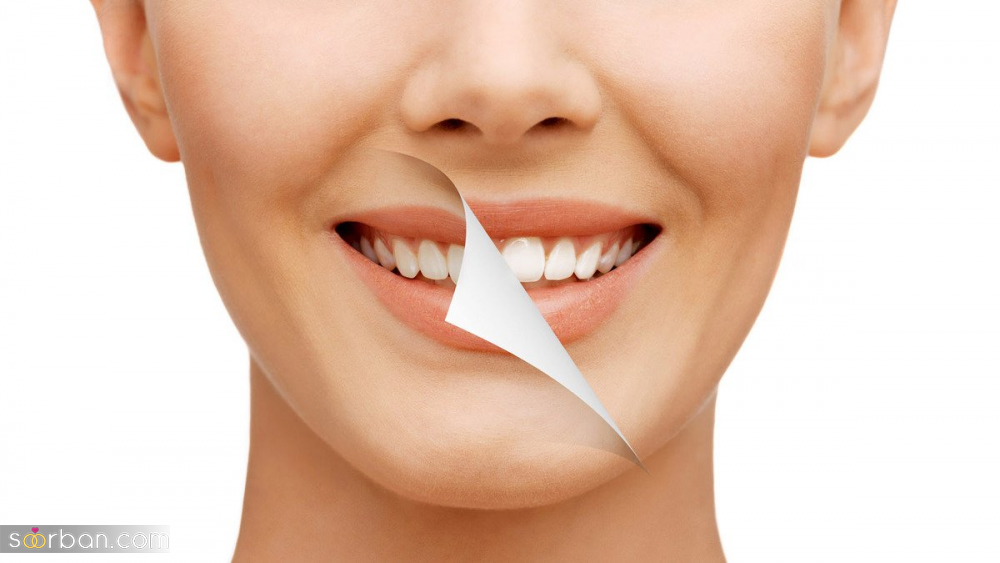 معرفی بهترین دندانپزشک طراحی لبخند در تهران