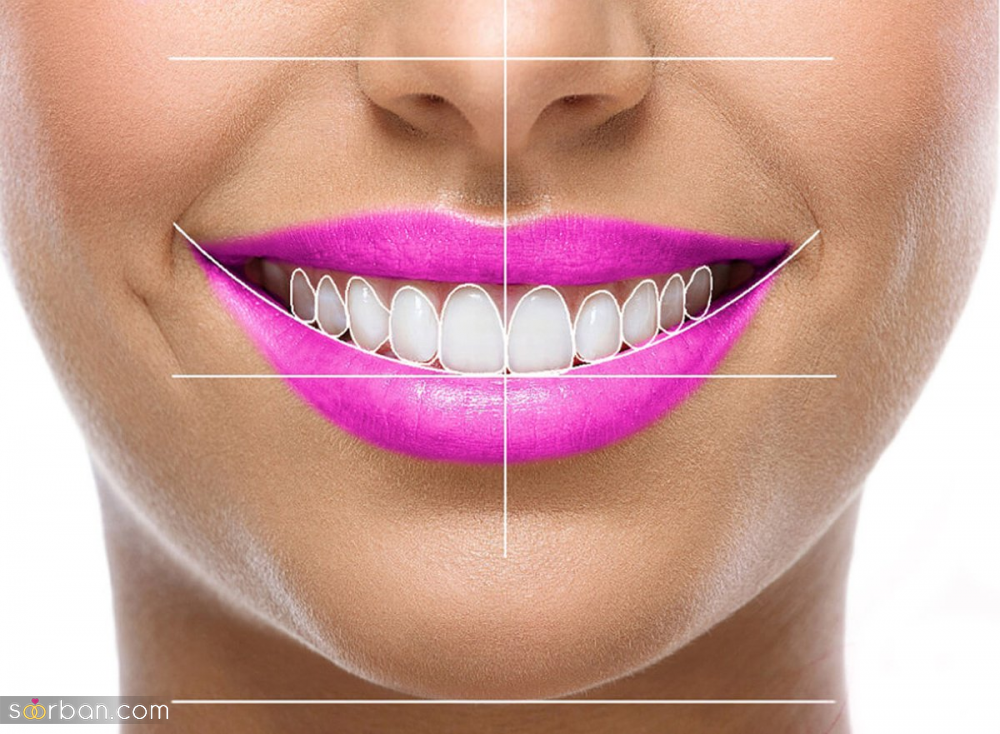معرفی بهترین دندانپزشک طراحی لبخند در تهران