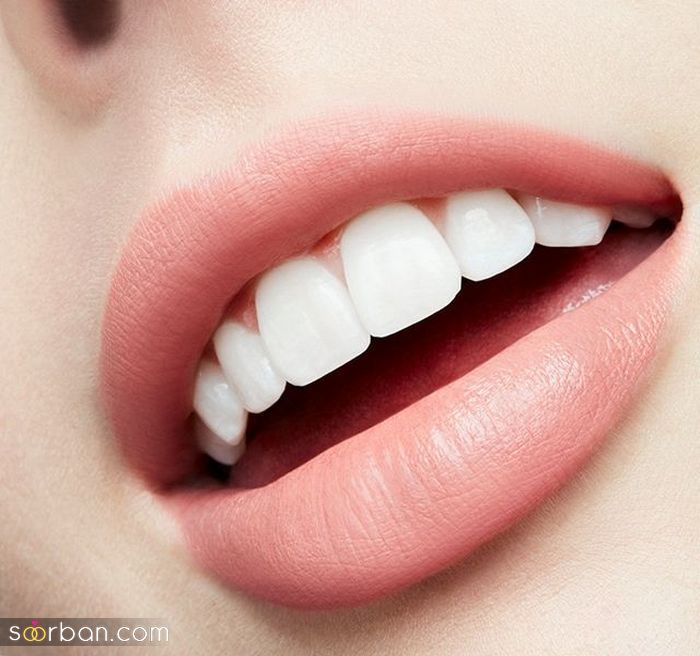 50 مدل رنگ رژ لب جیغ / ملیح بسیار دلنشین مجلسی (Lipstick color)