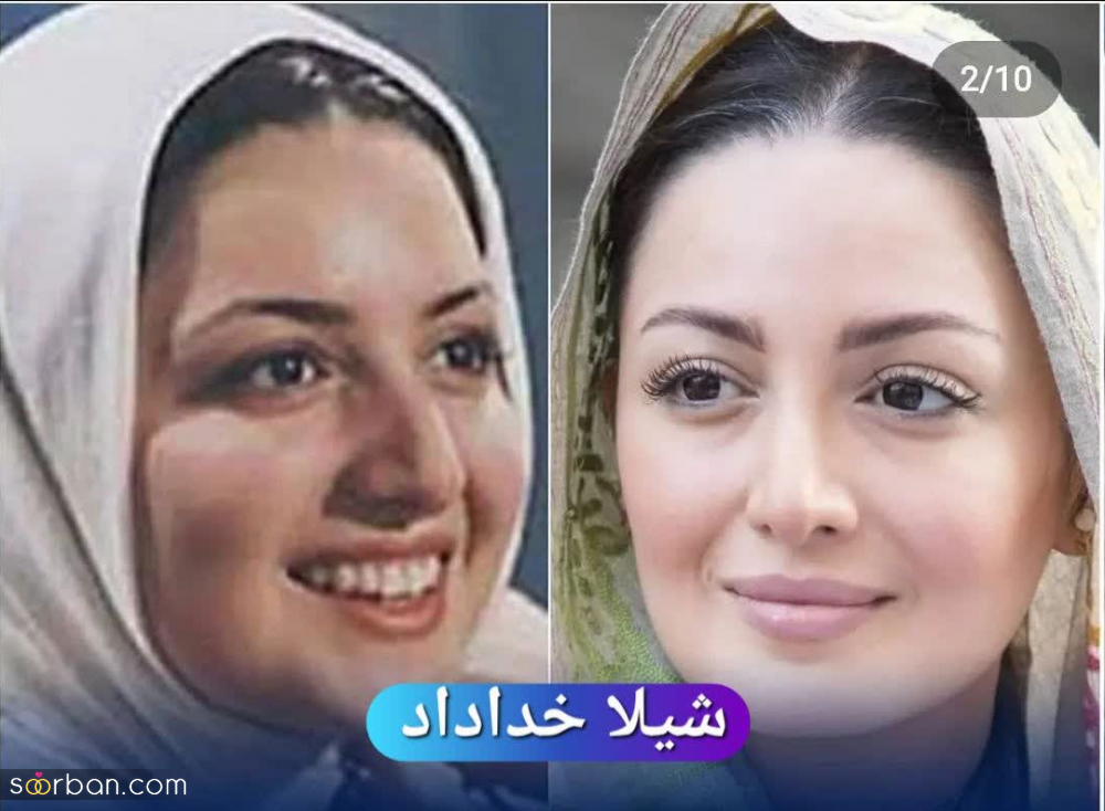 عکس های عجیب بازیگران زن ایرانی قبل و بعد از عمل زیبایی که شگفت زده‌تان میکند از الناز حبیبی تا طناز طباطبایی!
