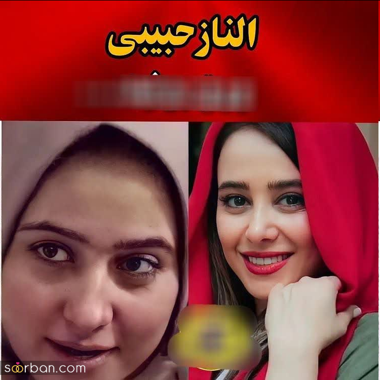 تصاویر جنجالی بازیگران زن ایرانی قبل از عمل بینی رو دیدی؟!