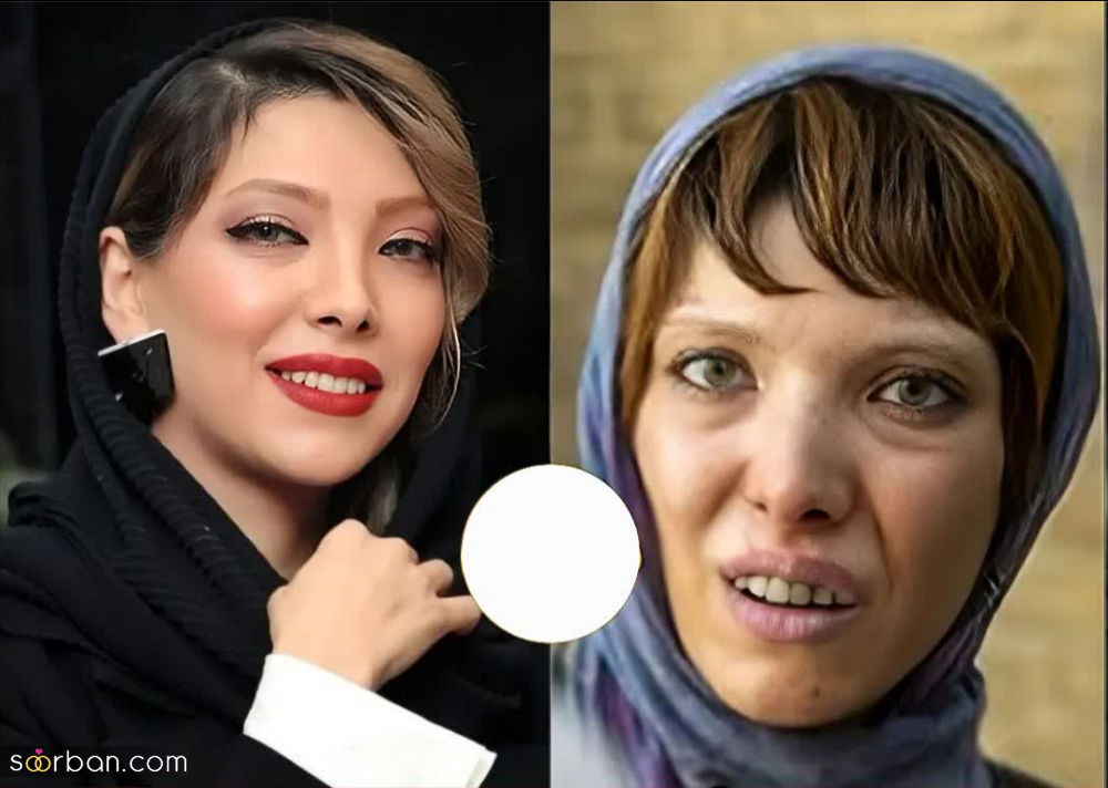 باورت میشه این بازیگرا برای ایفای نقش معتاد بیش 20 کیلو وزم کم کردند؟!