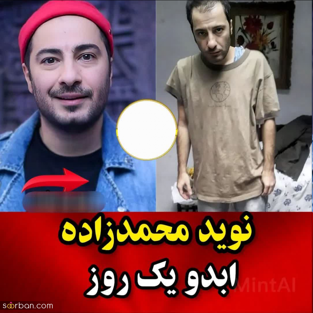 باورت میشه این بازیگرا برای ایفای نقش معتاد بیش 20 کیلو وزم کم کردند؟!