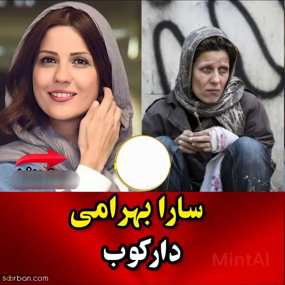 باورت میشه این بازیگرا برای ایفای نقش معتاد بیش 20 کیلو وزم کم کردند؟!