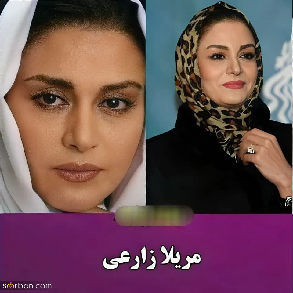 این بازیگران زن ایرانی ادعا می‌کنند نچرال بیوتی هستند و هیچ عمل زیبایی انجام نداده اند / کدوم خوشگلتره؟