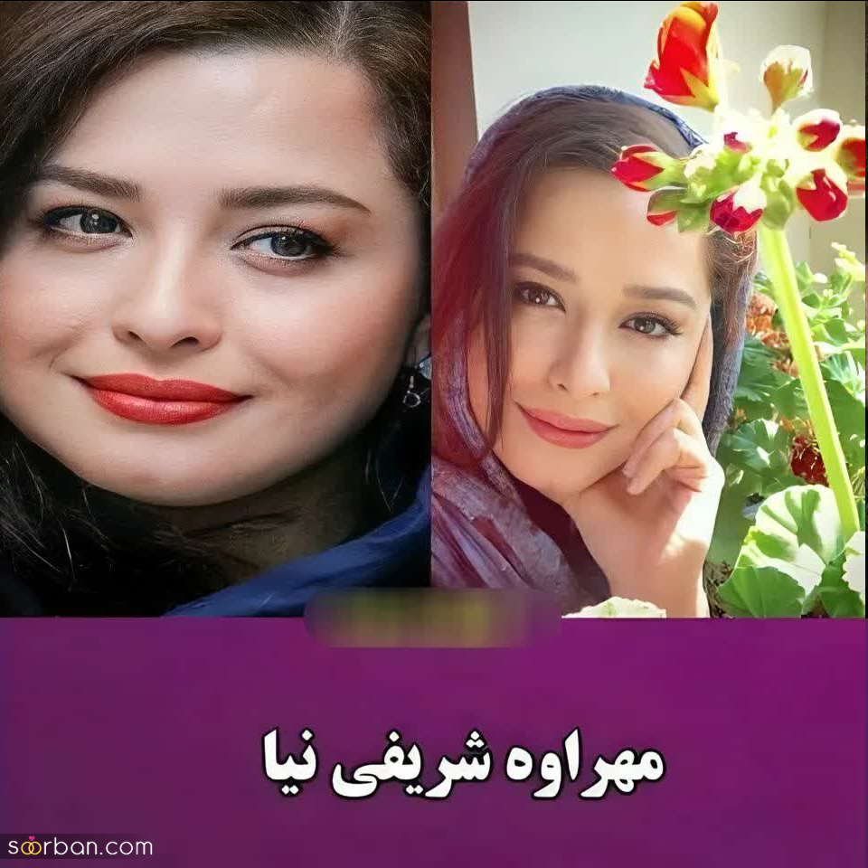 این بازیگران زن ایرانی ادعا می‌کنند نچرال بیوتی هستند و هیچ عمل زیبایی انجام نداده اند / کدوم خوشگلتره؟