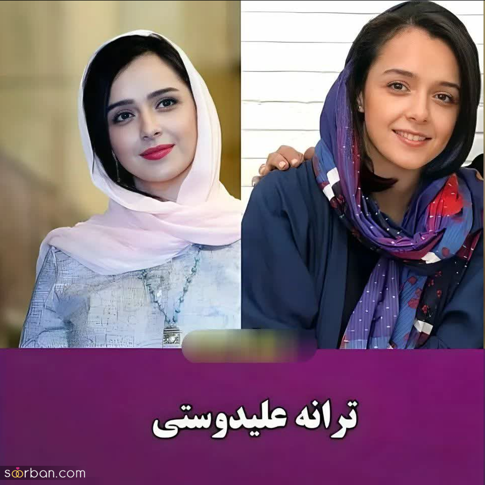 این بازیگران زن ایرانی ادعا می‌کنند نچرال بیوتی هستند و هیچ عمل زیبایی انجام نداده اند / کدوم خوشگلتره؟