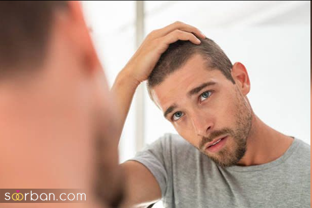 چرا موهات میریزه؟ 10 علت اصلی ریزش مو را بدانید!