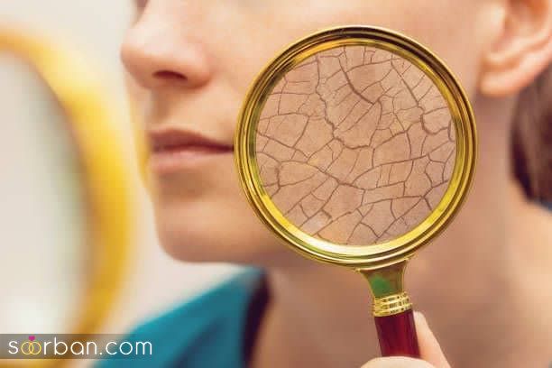 اگه کم آب میخوری منتظر این 10 عارضه‌ی ترسناک باش!