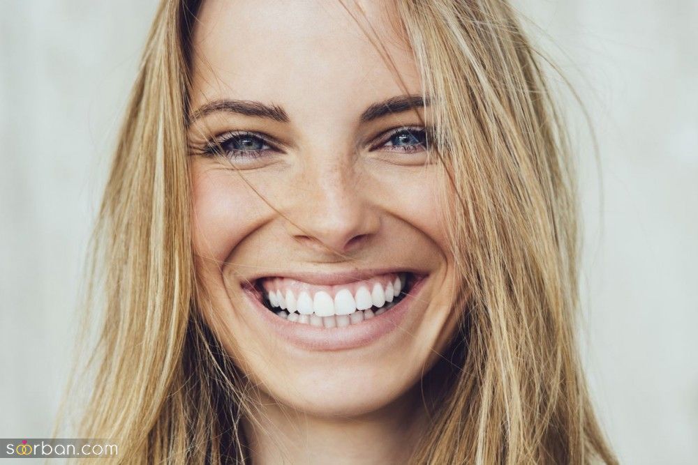 چطوری زیبا بخندیم؟ چگونه لبخند زیبا داشته باشیم؟ | 5 قدم تا خنده زیبا و دل انگیز