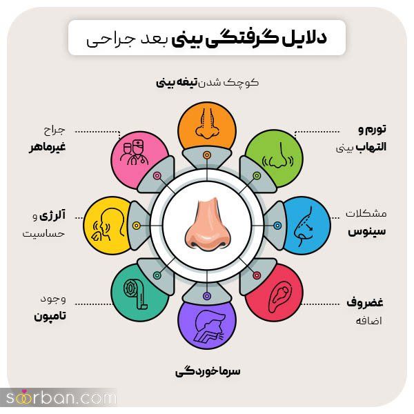 گرفتگی بینی بعد از عمل+ دلایل و راه های رفع گرفتگی بینی بعد از عمل