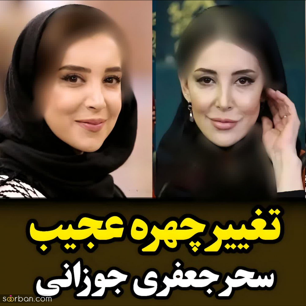 تغییر چهره جنجالی سحر جعفری جوزانی در 45 سالگی(تصاویر)/بازیگر سریال های مهران مدیری چرا اینشکلی شده؟!