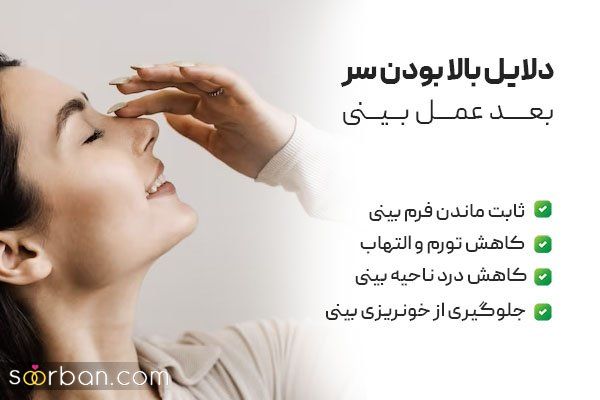 تا چند روز بعد عمل بینی باید سربالا باشد؟