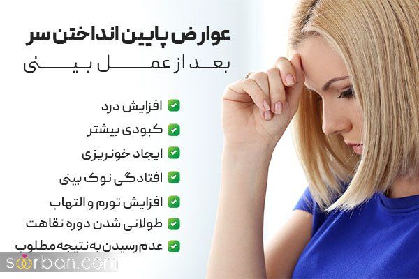 تا چند روز بعد عمل بینی باید سربالا باشد؟