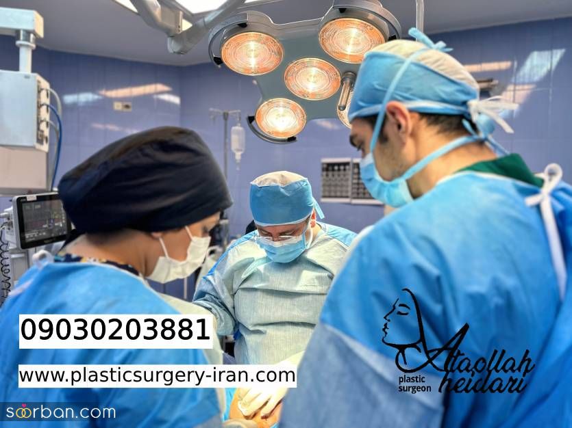 7 تا از بهترین جراحان بینی طبیعی در تهران