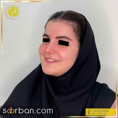 انتخاب بهترین جراح بینی رشت