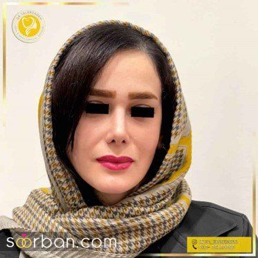 انتخاب بهترین جراح بینی رشت