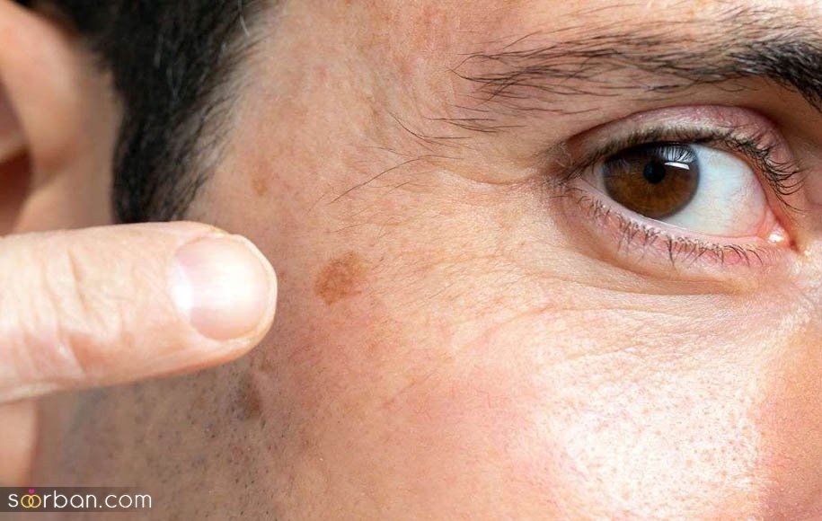 کرم ضد لک چه مارکی خوبه بخریم؟