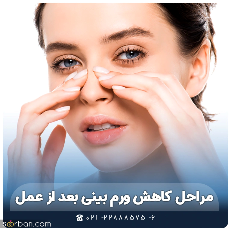 ورم بینی گوشتی بعد از عمل چقدر طول میکشد؟