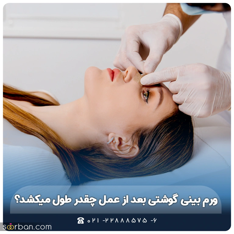 ورم بینی گوشتی بعد از عمل چقدر طول میکشد؟