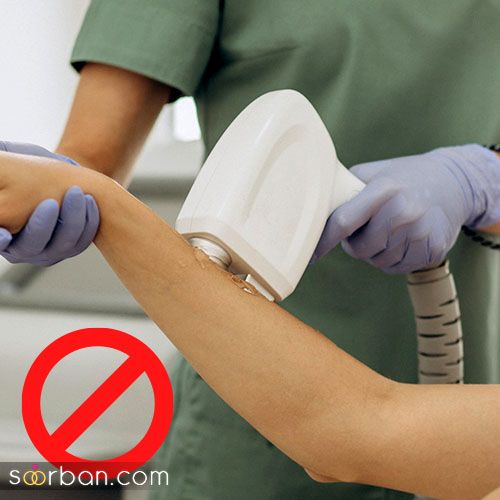 چه کسانی نمی توانند لیزر کنند ؟ (10 ممنوعیت لیزر موهای زائد)