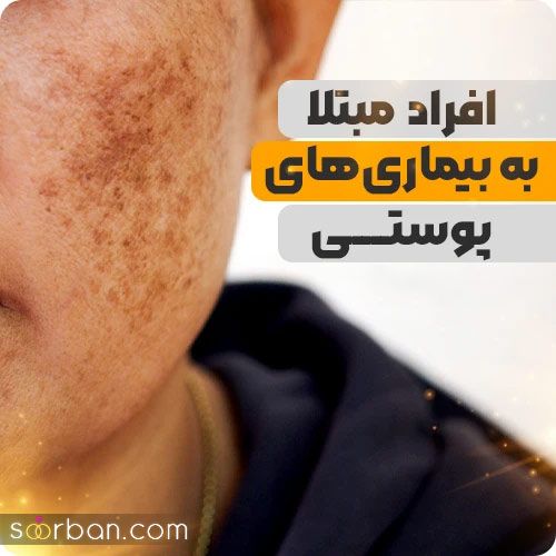 چه کسانی نمی توانند لیزر کنند ؟ (10 ممنوعیت لیزر موهای زائد)