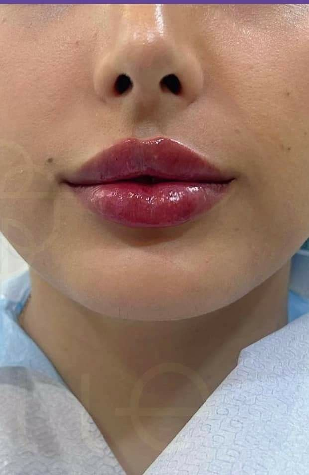 مدل ژل لب روسی : ۲۵ مدل ژل لب روسی که لب‌هات رو عروسکی، نچرال یا حجیم می‌کنن! + نکات طلایی انتخاب بهترین مدل!