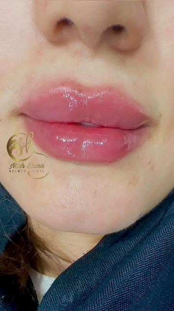 مدل ژل لب روسی : ۲۵ مدل ژل لب روسی که لب‌هات رو عروسکی، نچرال یا حجیم می‌کنن! + نکات طلایی انتخاب بهترین مدل!