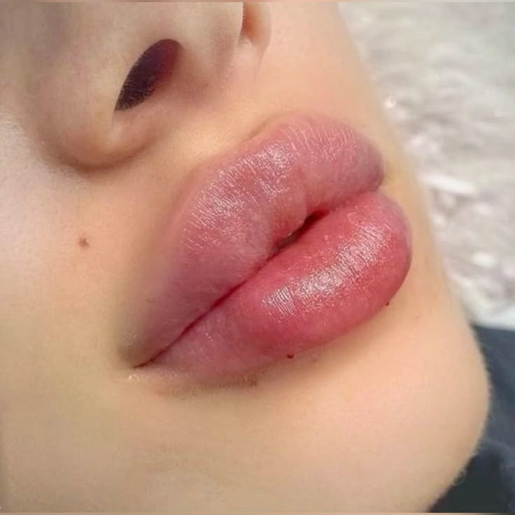 مدل ژل لب طبیعی | ۲۰ مدل ژل لب طبیعی جذاب ۲۰۲۵ که هیچ‌کس نمی‌فهمه ژل زدی! مخصوص عاشقای لب نچرال + نکات مهم تزریق!