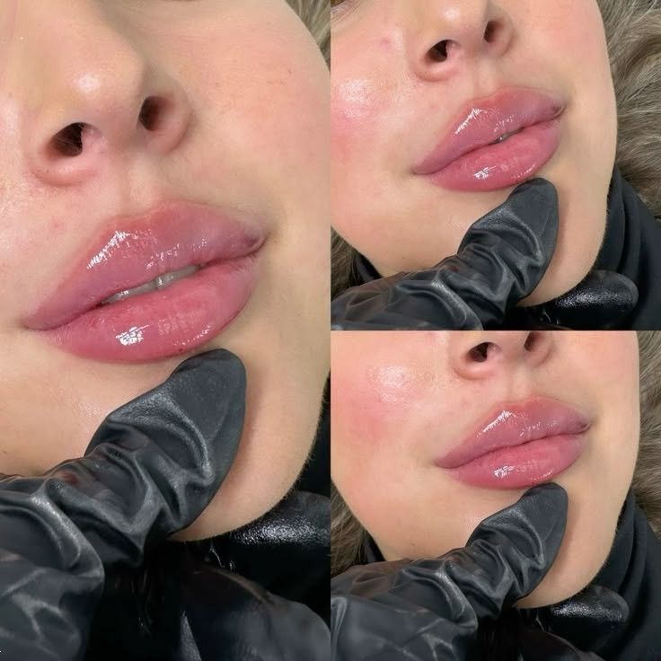 مدل لب روسی | ۲۵ مدل جدید لب روسی ۲۰۲۵ برای داشتن لب‌های عروسکی و قلوه‌ای + نکات طلایی قبل و بعد از تزریق ژل!