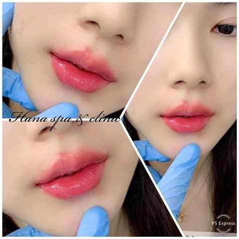 مدل ژل لب | ۱۰ ترند برتر مدل ژل لب ۲۰۲۵؛ کدوم فرم به چهره‌ات میاد؟ (عروسکی، نچرال، روسی و کره‌ای)