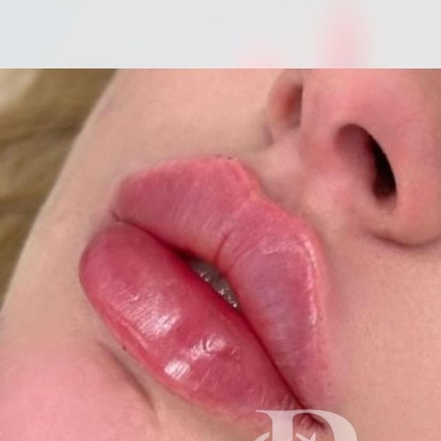 مدل ژل لب | ۱۰ ترند برتر مدل ژل لب ۲۰۲۵؛ کدوم فرم به چهره‌ات میاد؟ (عروسکی، نچرال، روسی و کره‌ای)