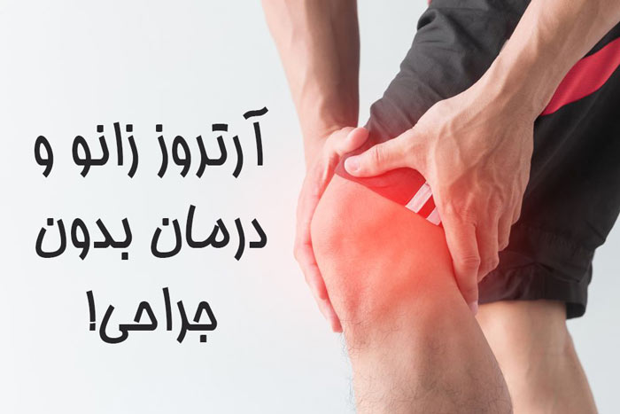 آرتروز زانو و درمانهای بدون جراحی