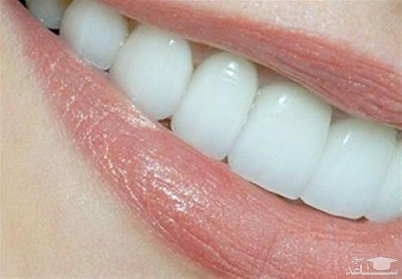 دلایل مهم شکستن دندان چیست؟