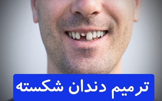 دلایل مهم شکستن دندان چیست؟