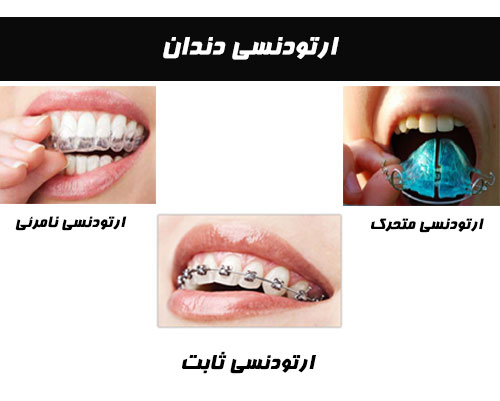 کلینیک های ارتودنسی برتر تهران