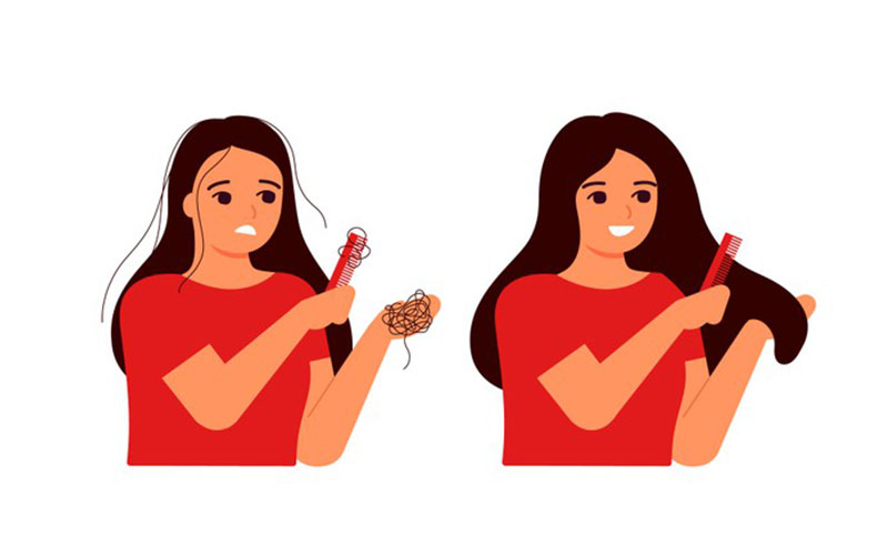 کمبود کدام ویتامین باعث ریزش مو می شود ؟