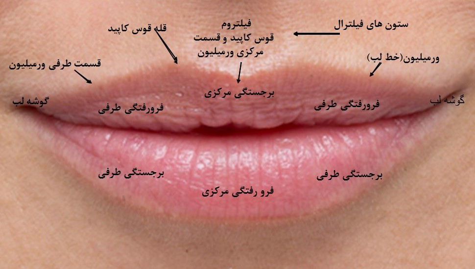 همه چیز درباره تزریق ژل لب