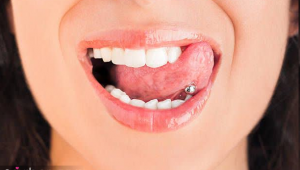 آشنایی با پیرسینگ لب و دهان و خطرات جبران ناپذیر آن از نظر دندان پزشکان.