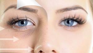 بهترین برند فیلر زیر چشم چیست؟ | معرفی 7 مارک فیلر زیر چشم محبوب و پرطرفدار