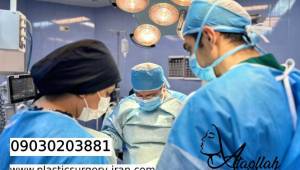7 تا از بهترین جراحان بینی طبیعی در تهران
