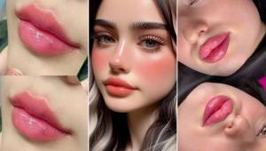 مدل ژل لب | ۱۰ ترند برتر مدل ژل لب ۲۰۲۵؛ کدوم فرم به چهره‌ات میاد؟ (عروسکی، نچرال، روسی و کره‌ای)