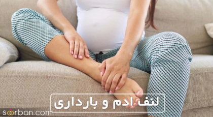 ورم دست و پا در دوران بارداری ( لنف ادم اندام ها)