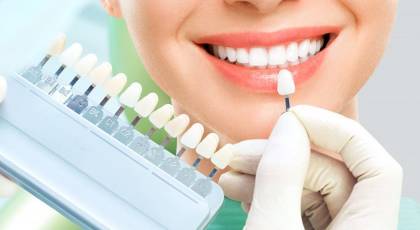 بهترین مارک کامپوزیت دندان چیست؟ | معرفی 8 بهترین برند کامپوزیت دندان 2023