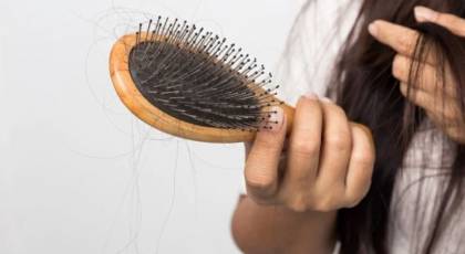 بهترین درمان های گیاهی برای ریزش مو - 4 محصول گیاهی درمان ریزش مو و رویش مجدد مو
