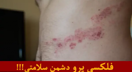 فلکسی پرو  خطرناک ترین روش برای درمان کمر درد