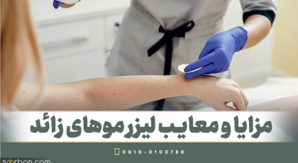 مزایا و معایب لیزر موهای زائد بدن